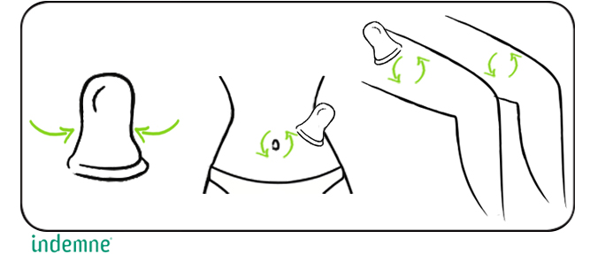 Ventouse minceur anti cellulite pour réduire la cellulite grâce au massage du palper rouler